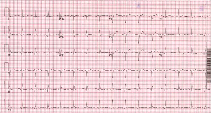 On teaching EKG’s and family meetings