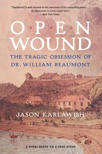 Open Wound by Karlawish – A Wonderful Read